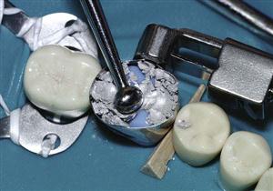 GDC Double Ended T-Burnisher 3 - TB2