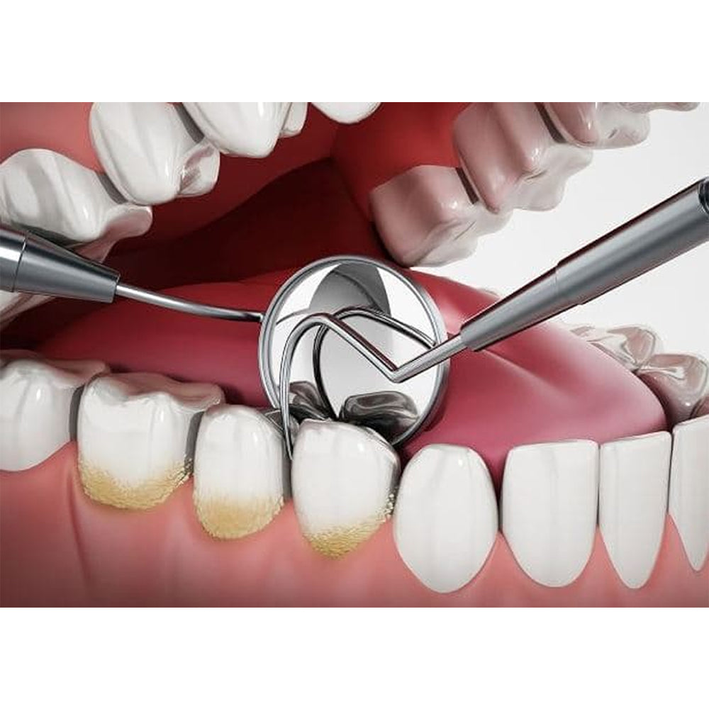 GDC Single End Probe 1 - EXS23