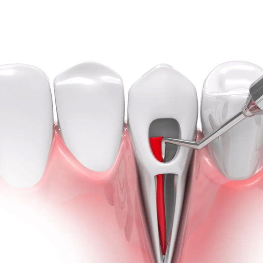 GDC Spreaders 1 - RCSGP1