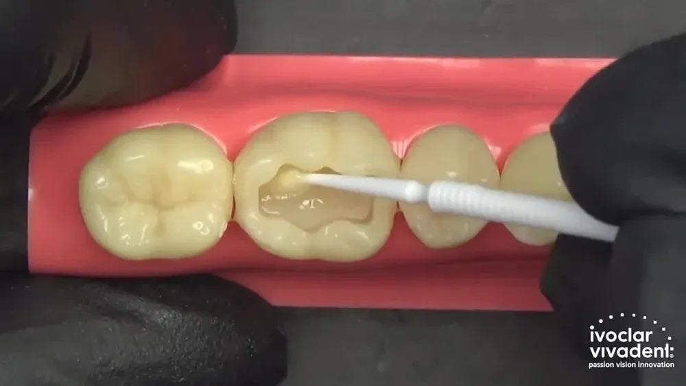 IVOCLAR Tetric N-Bond | Total Etch Dental Adhesive