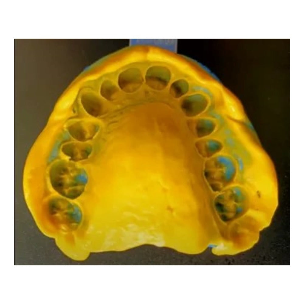 Prevest Accusil Impression Material Combo Kit | 2 X 300ml Base/ Catalyst Putty, Light Body 2 x 50ml Base/ Catalyst Paste