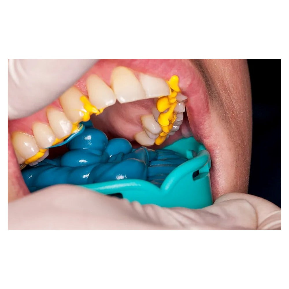 Prevest Accusil Impression Material Combo Kit | 2 X 300ml Base/ Catalyst Putty, Light Body 2 x 50ml Base/ Catalyst Paste