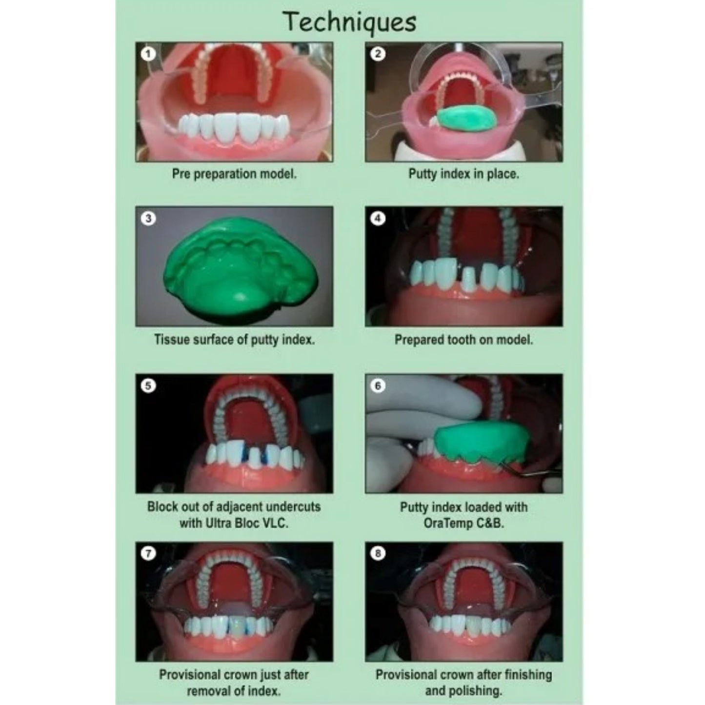 Prevest Denpro Oratemp C&B | Crown & Bridge Material