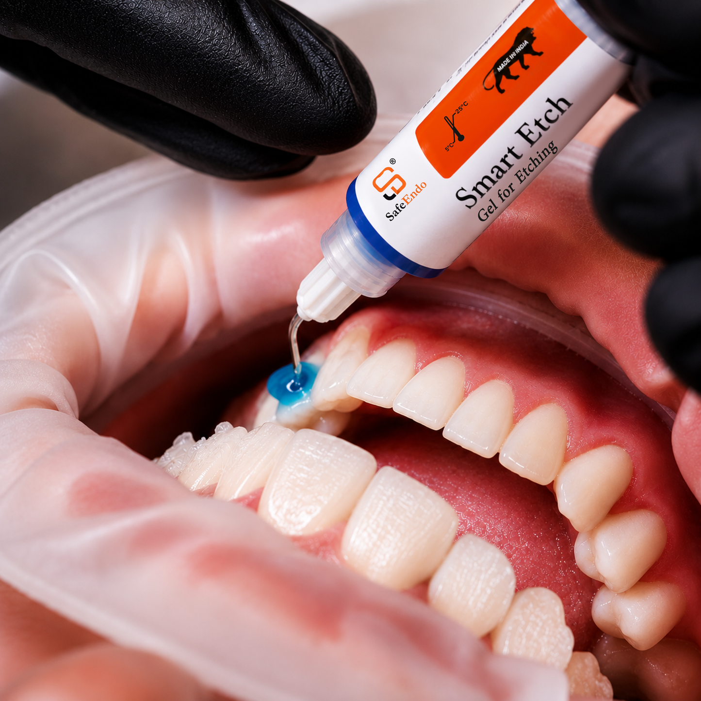 SafeEndo Smart Etch 5ml | Etching Gel for Dentin and Enamel