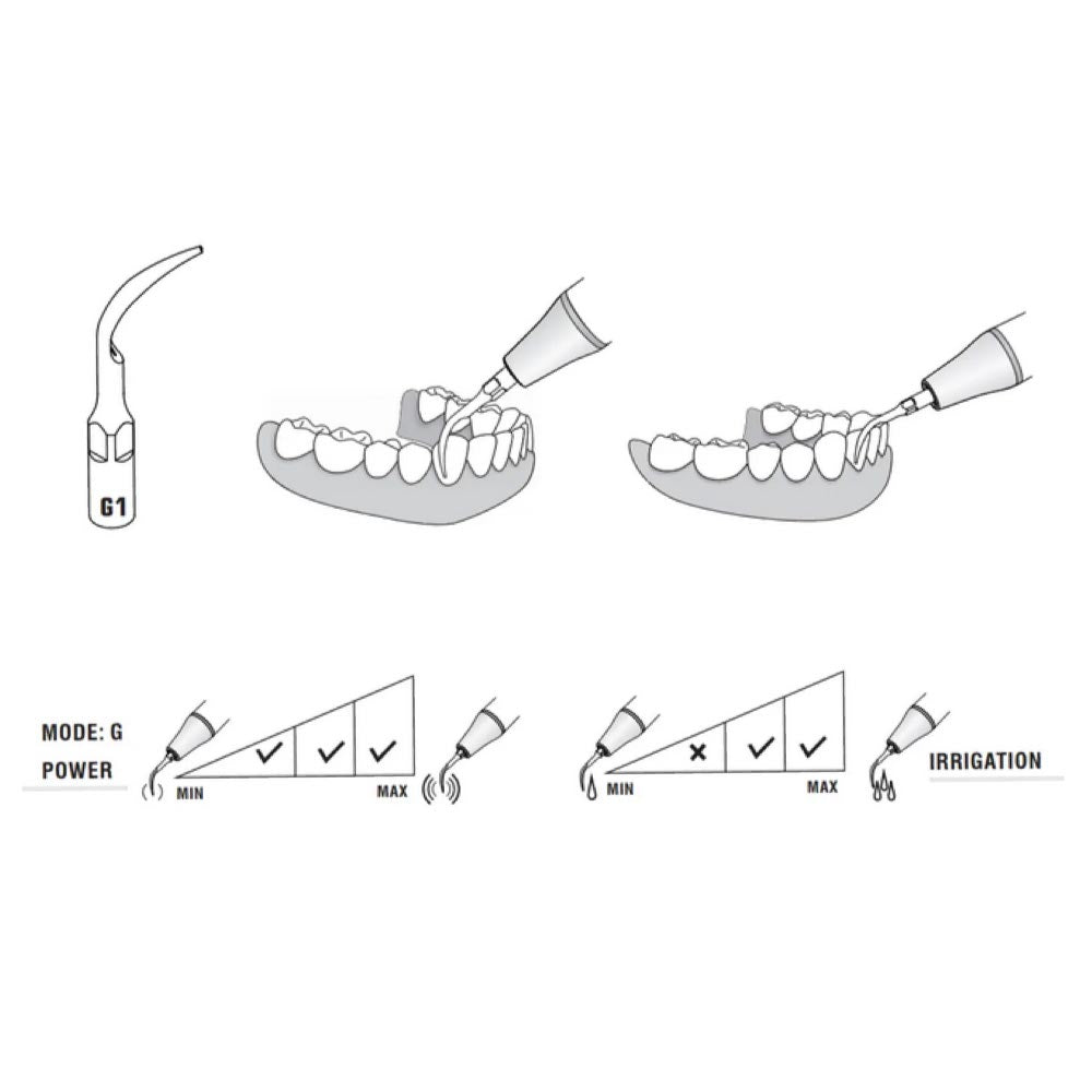 Woodpecker Scaler Tip G1 for UDS & EMS Scalers