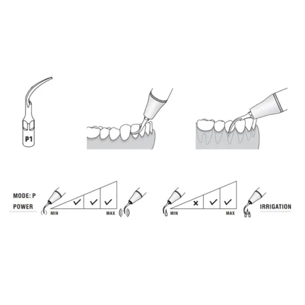 Woodpecker Scaler Tip P1 for UDS & EMS Scalers