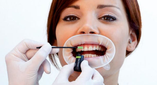 IVOCLAR Fluor Protector Dental Varnish