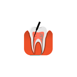 Endodontics Equipment