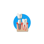 Implantology Equipment & Instruments