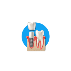 Implantology Equipment & Instruments