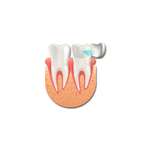 Prosthodontics