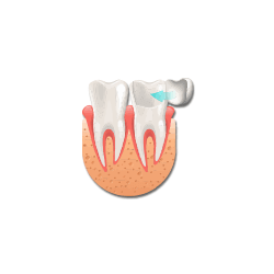Prosthodontics