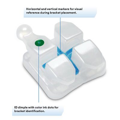 3M Unitek Clarity Advanced Ceramic Brackets