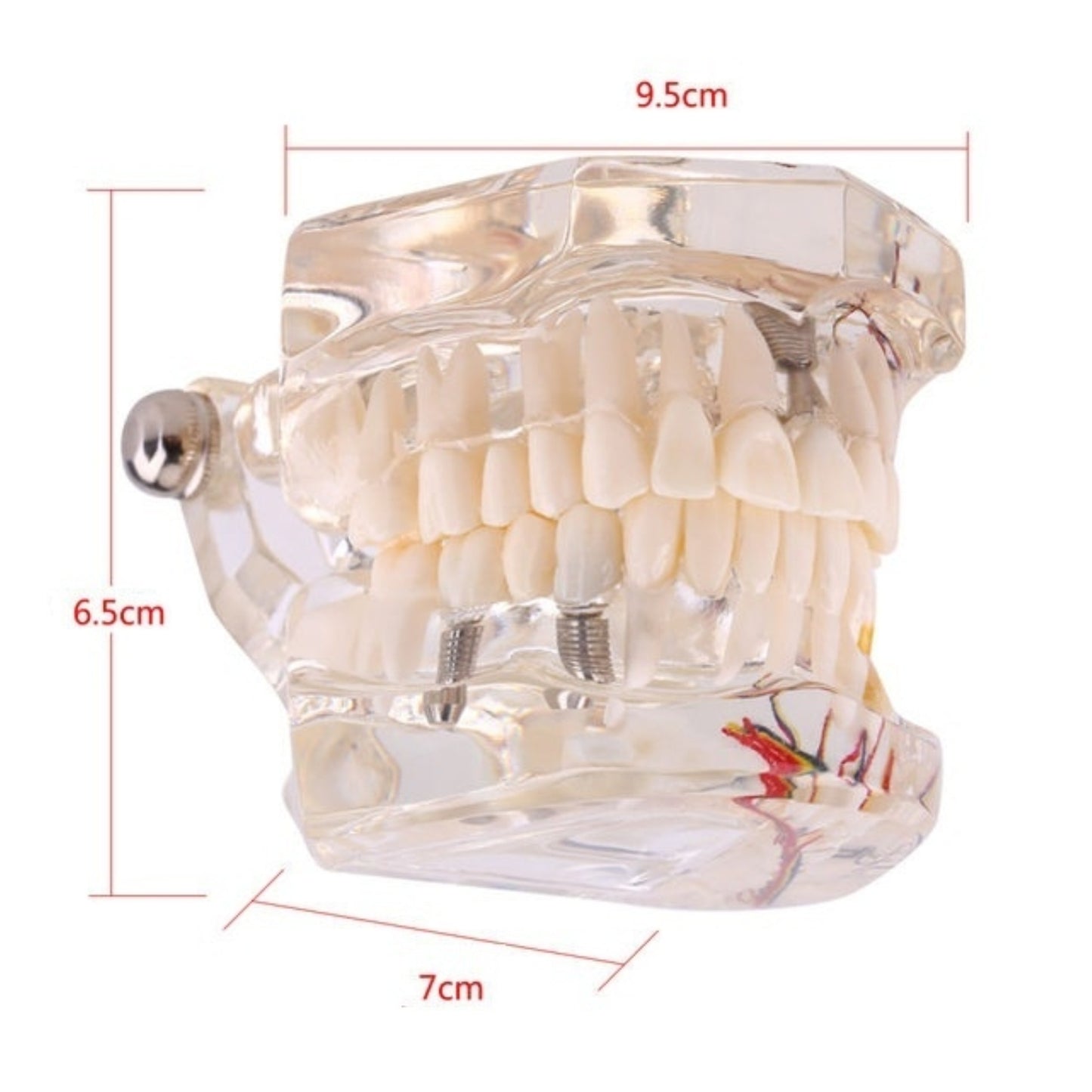 Dental All In One Implant Study Model | Transparent White