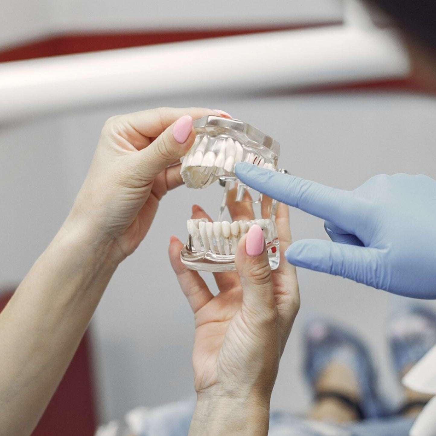 Dental All In One Implant Study Model | Transparent White