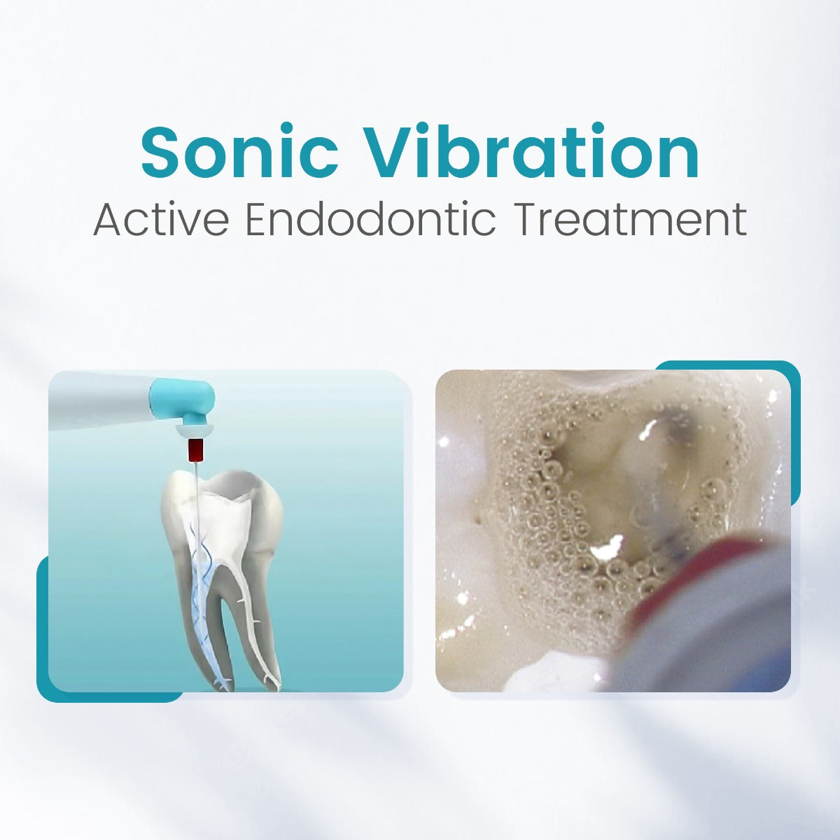Dental Sonic Endo Irrigator With 120 Tips | Endodontic Irrigator