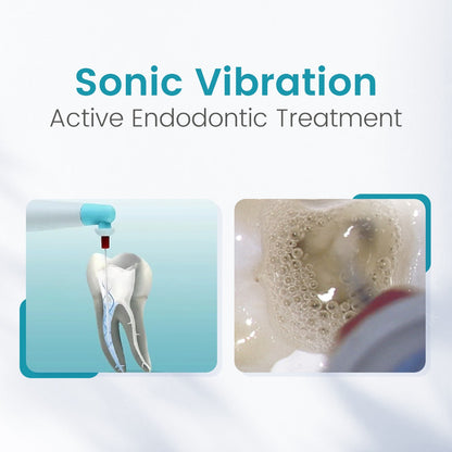 Dental Sonic Endo Irrigator With 120 Tips | Endodontic Irrigator