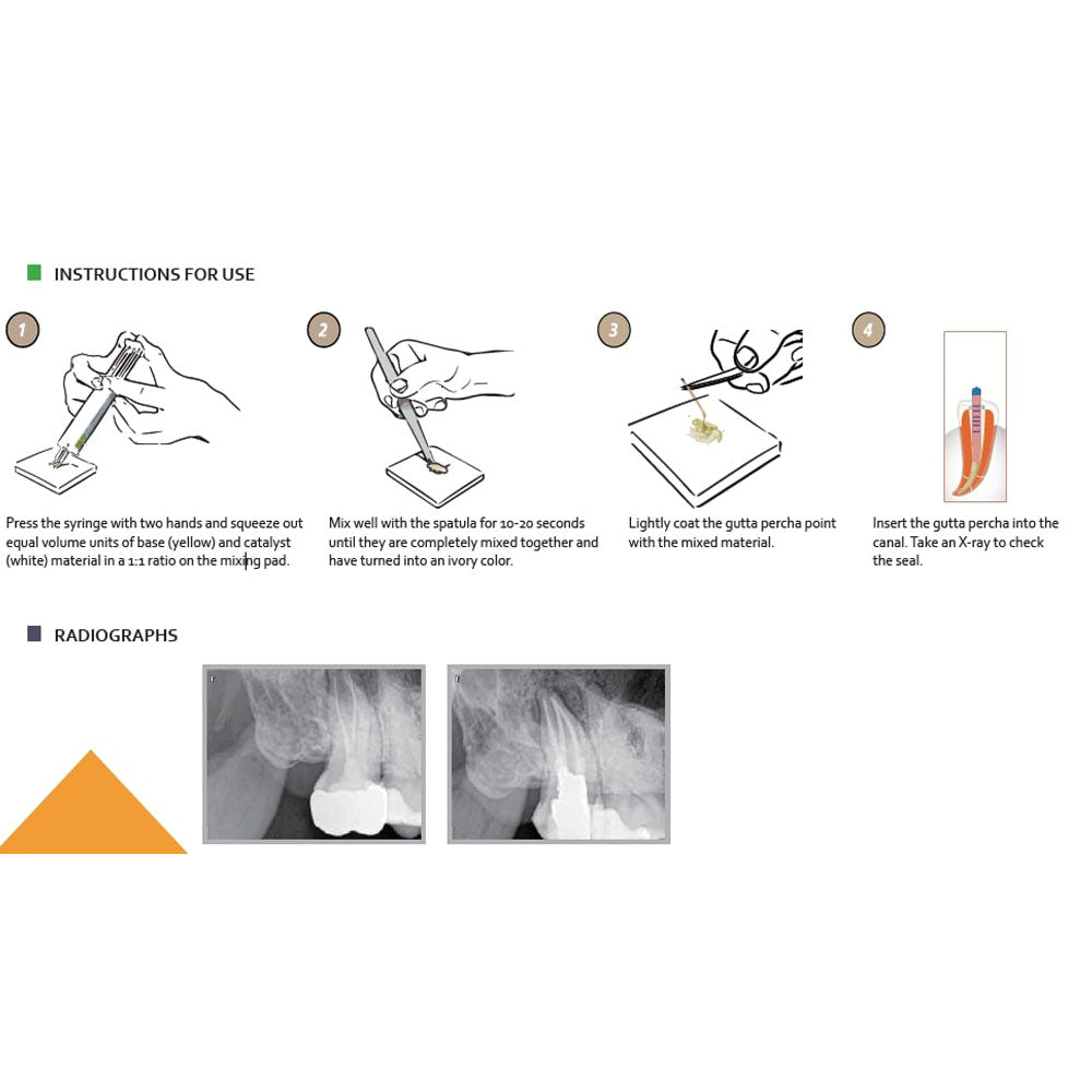 Dia-Dent Dia-Proseal | Root Canal Sealer