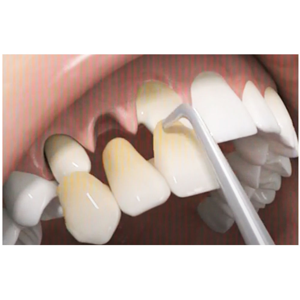 GDC Automatic Premium Crown Remover - CRP
