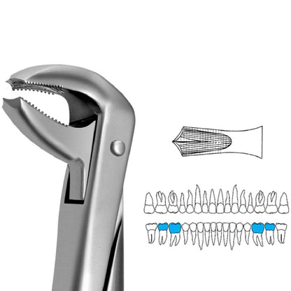 GDC Extraction Forceps Lower Molars FX73S | 73 Standard