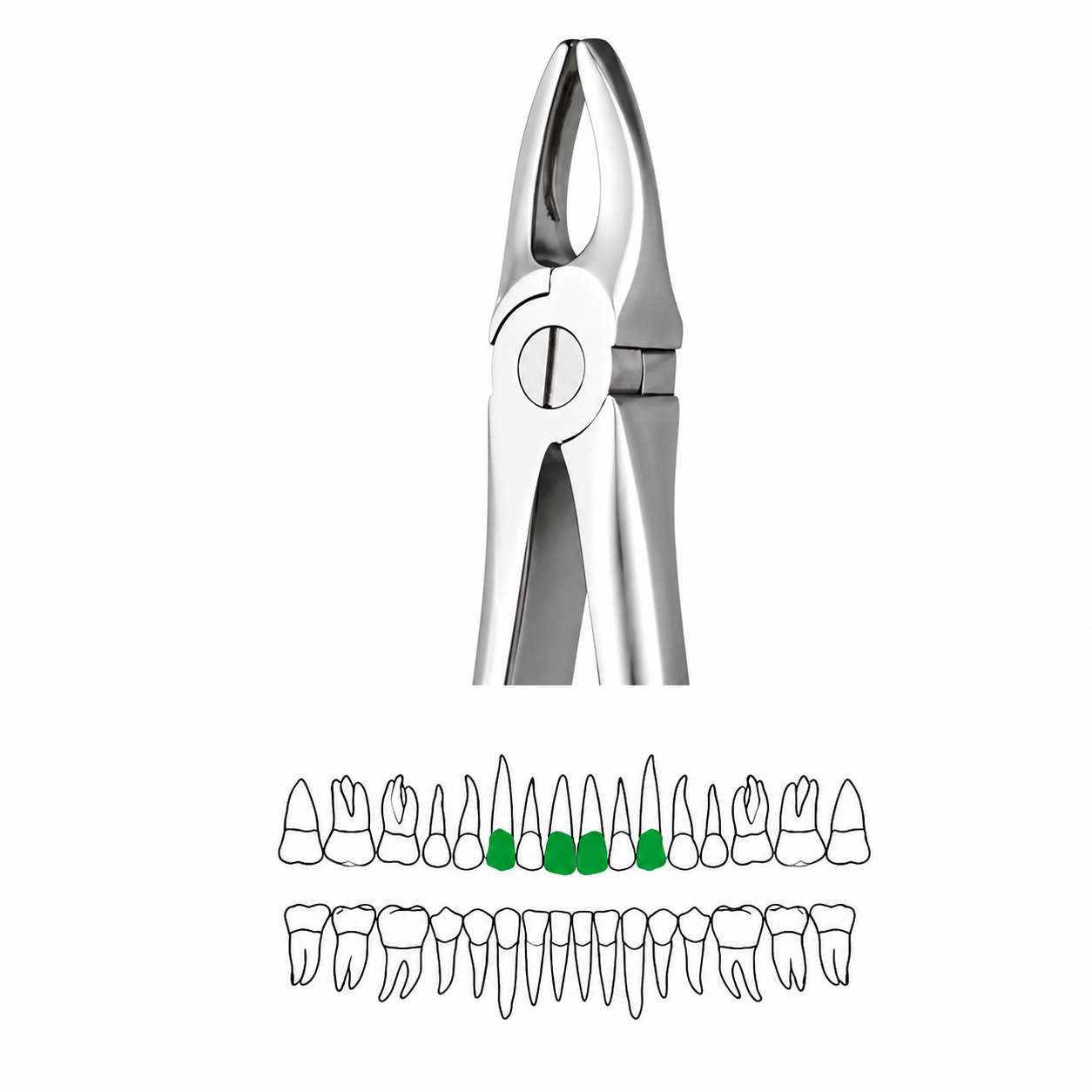 GDC Extraction Forceps Upper Anteriors FX1S | 1 Standard