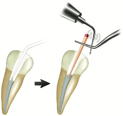 GDC G.P. Holding Tweezer - Premium - EPL1