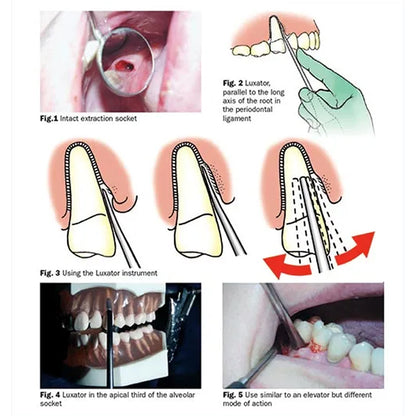 GDC Luxatip - 2mm Straight - L2S