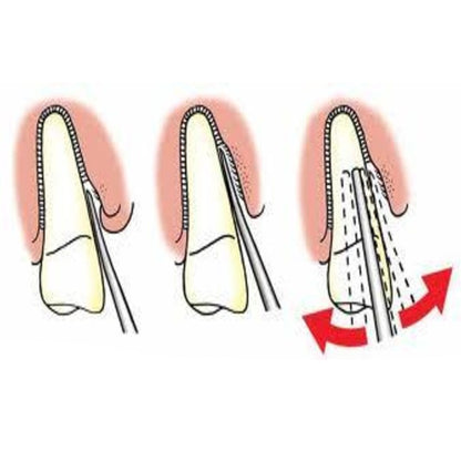 GDC Luxatip - 3mm Straight - L3S