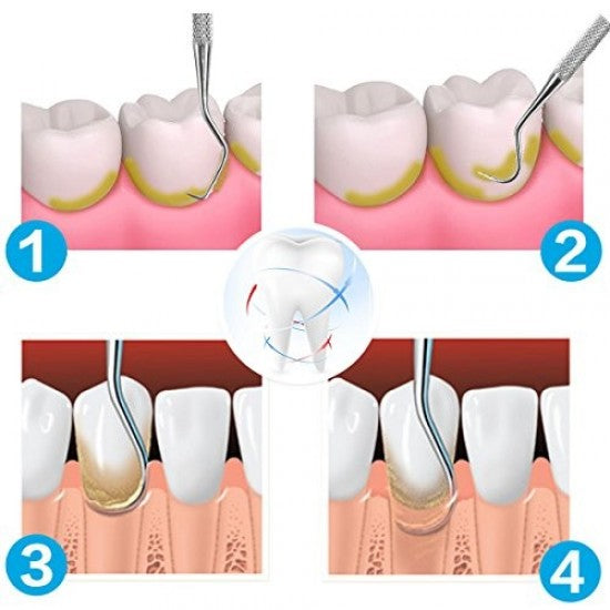 GDC Manipal Scaler Set Of 3 PCS Instruments Kit