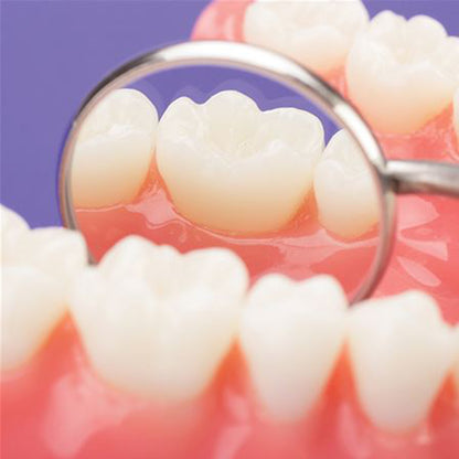 GDC Mouth Mirror Tops Plain Pack Of 12 - 4 - MMTP4