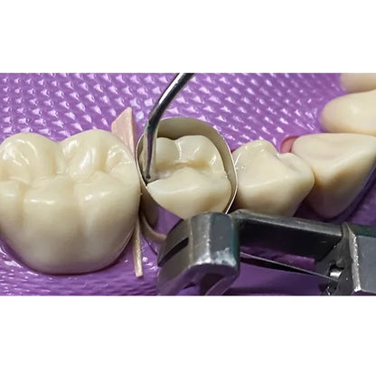 GDC Plastic Filling Instrument 3 - PFGFT1