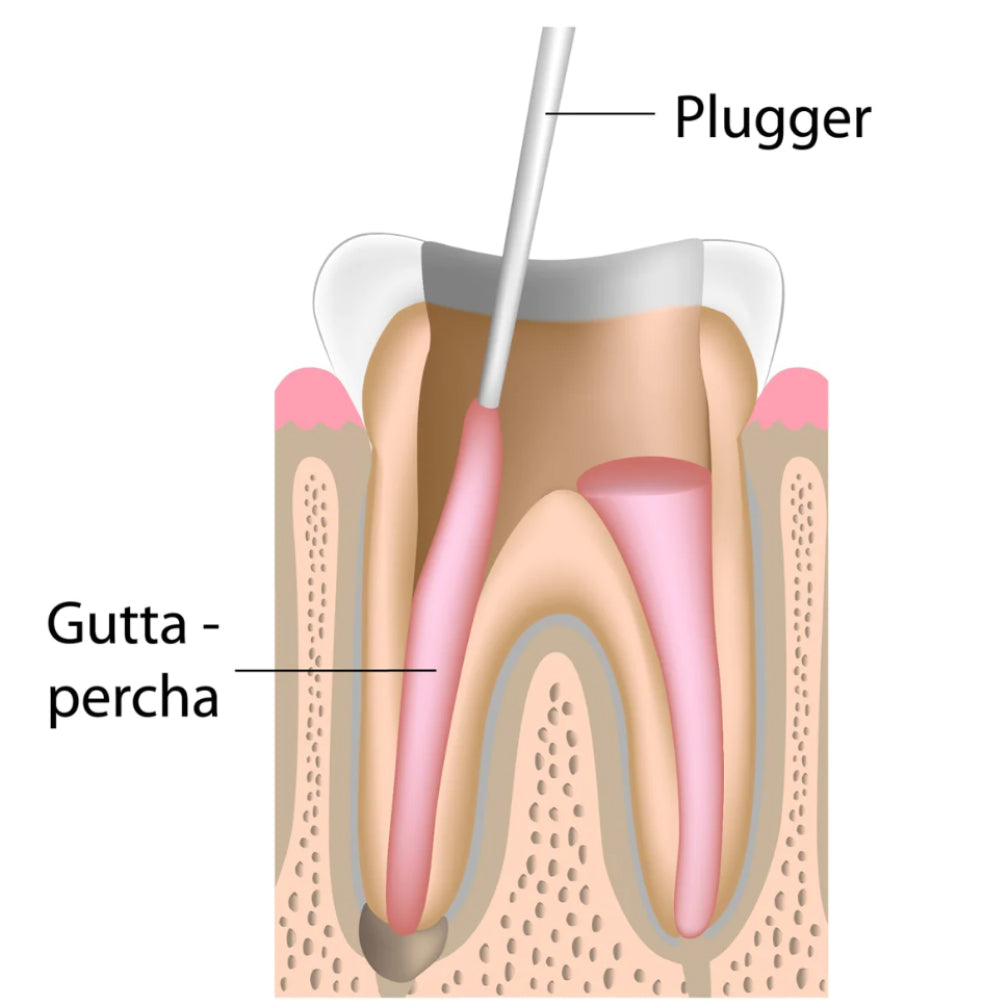 GDC Root Canal Plugger .40mm 3 - RCP40