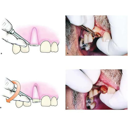 GDC Root Elevator Apical Standard - E1F