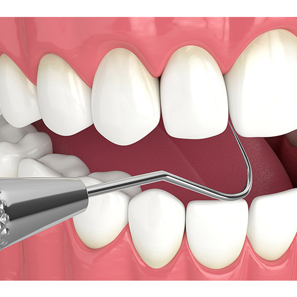 GDC Single End Probe 1 - EXS54