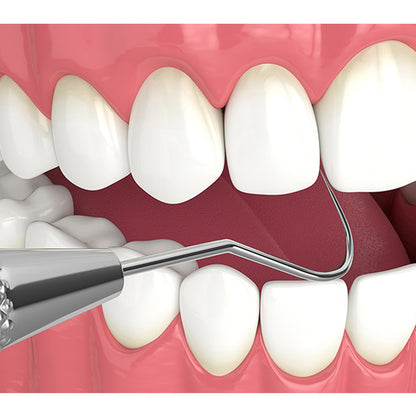 GDC Single End Probe 1 - EXS54
