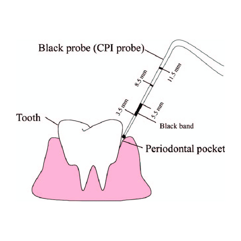 GDC Single End Probes 1 - PCP11.5B