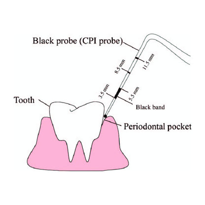 GDC Single End Probes 1 - PCP11.5B