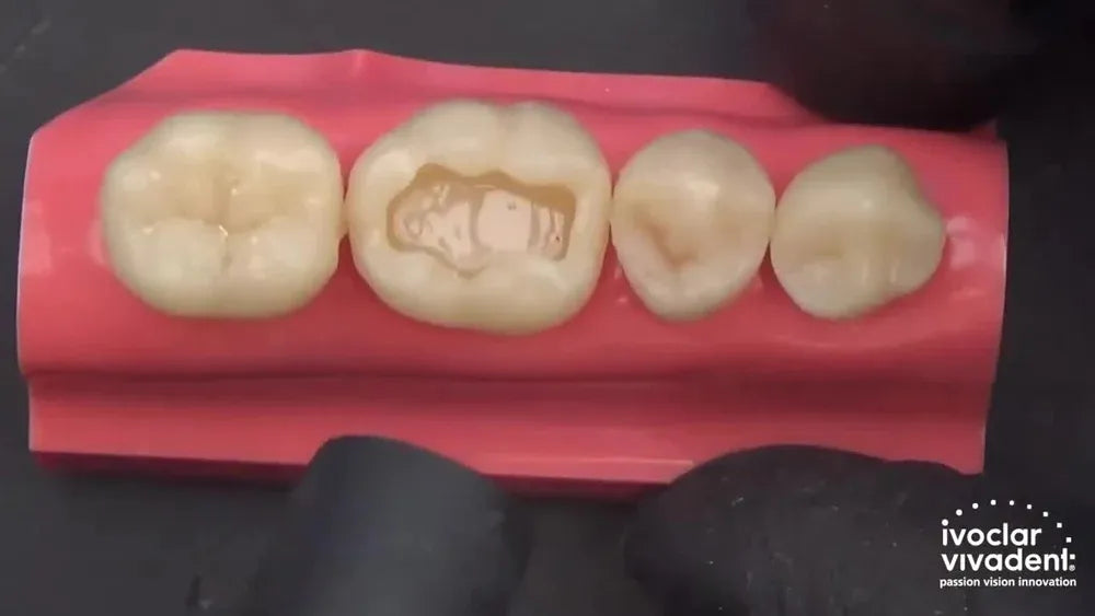 IVOCLAR Tetric N-Bond Universal 3GM | Bonding Agent