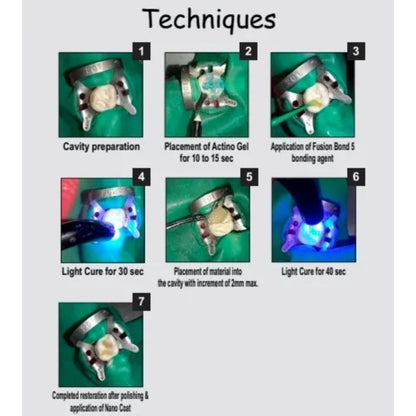 Prevest Fusion Universal Composite Kit | Light Cured Universal Nano Hybrid Composite