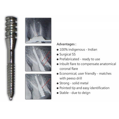Prime Dental i Post #3P Pack of 10 Integrated Endodontic Metal Post