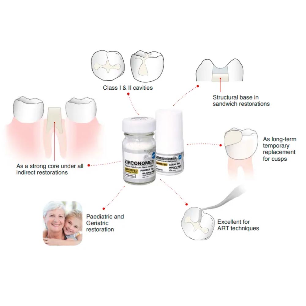SHOFU Zirconomer Improved | Zirconia-Reinforced Glass Ionomer Restorative