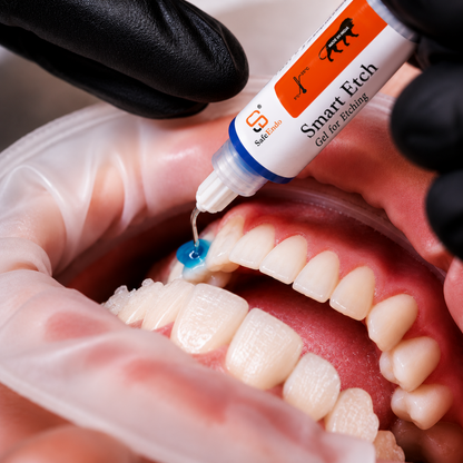 SafeEndo Smart Etch 5ml | Etching Gel for Dentin and Enamel