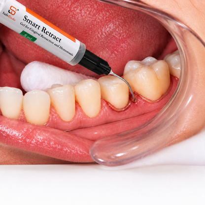 SafeEndo Smart Retract 5ml Syringe | Gingival Retraction Gel Liquid for Hemostasis