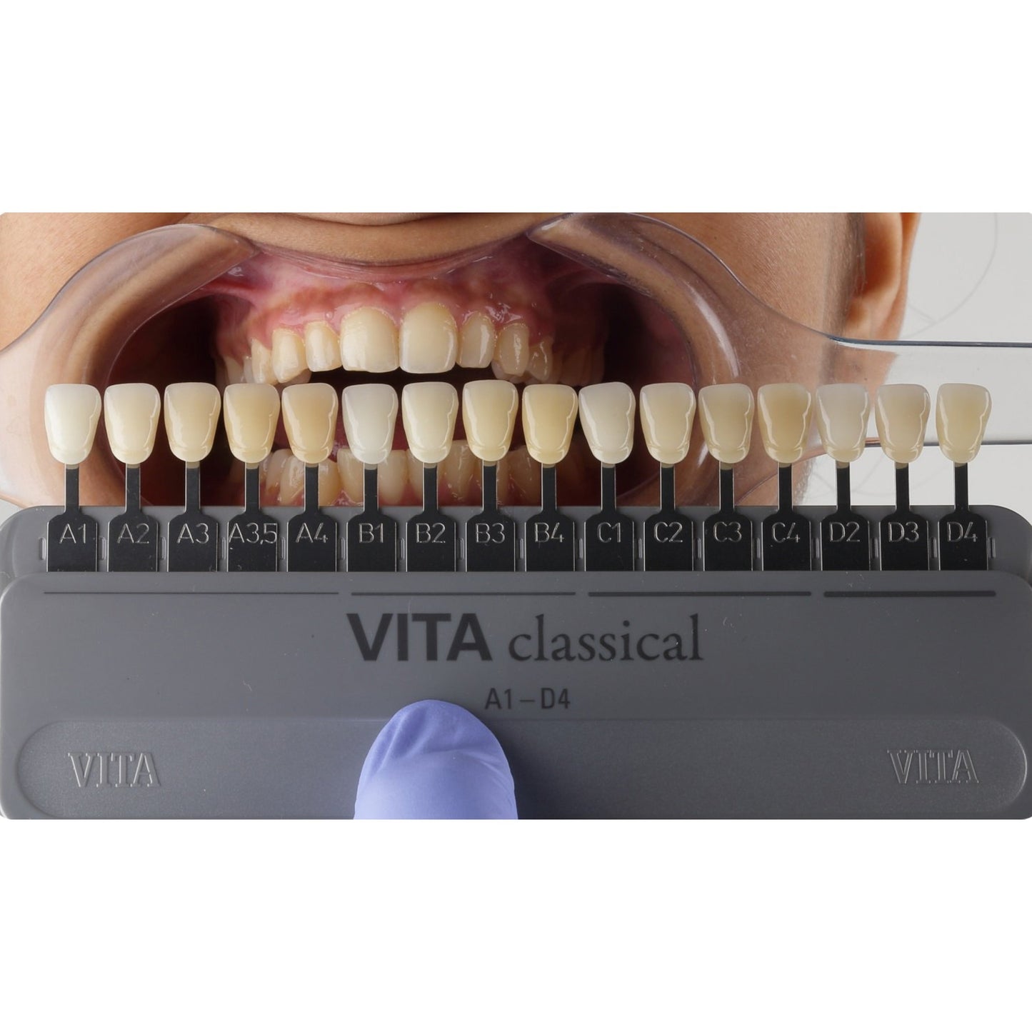 VITA Classical Shade Guide