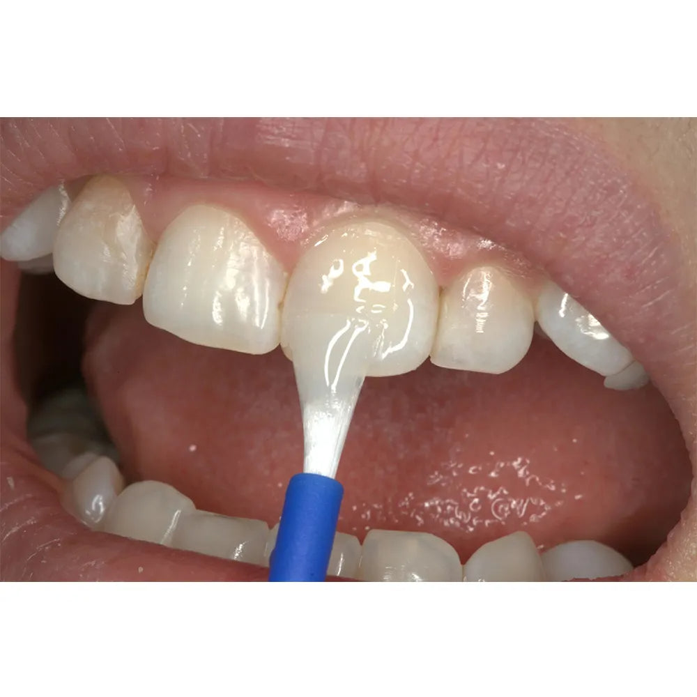 VOCO Profluorid Varnish Single Dose 48 X 0.40ML Mixed