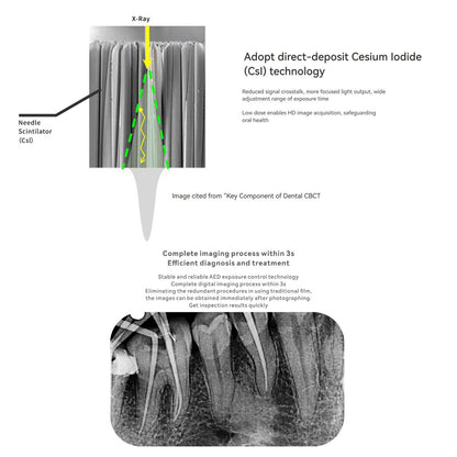 Woodpecker Intelli-Sensor RVG Size 1.5 | Digital Dental X-Ray Sensor