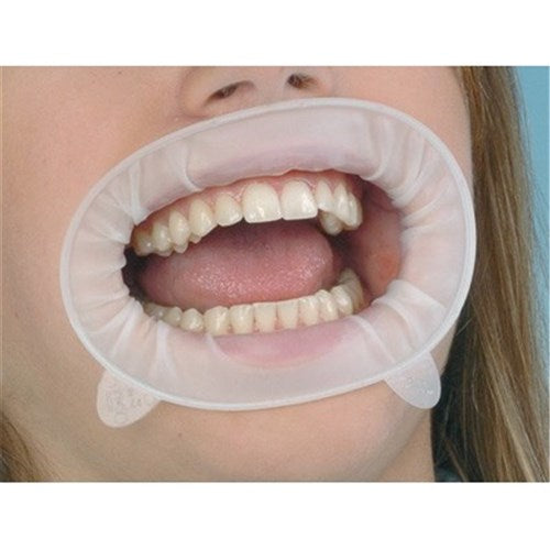 IVOCLAR Optragate (Pack Of 5)