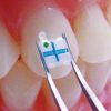 3M Unitek Clarity Advanced Ceramic Brackets - Image 6