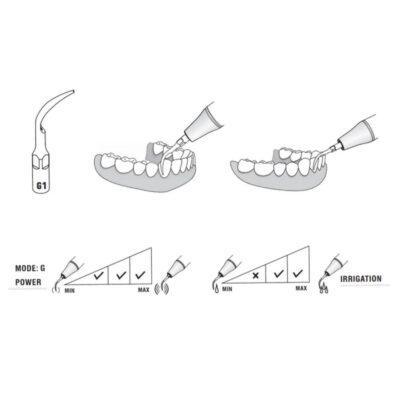 Woodpecker Scaler Tip G1 for UDS & EMS Scalers - Image 4