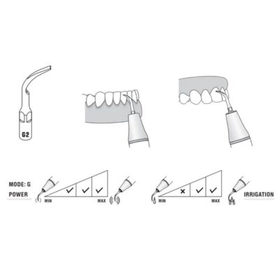 Woodpecker Scaler Tip G2 for UDS & EMS Scalers - Image 4